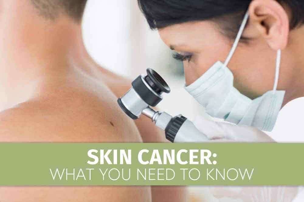 Skin-Cancer1-1