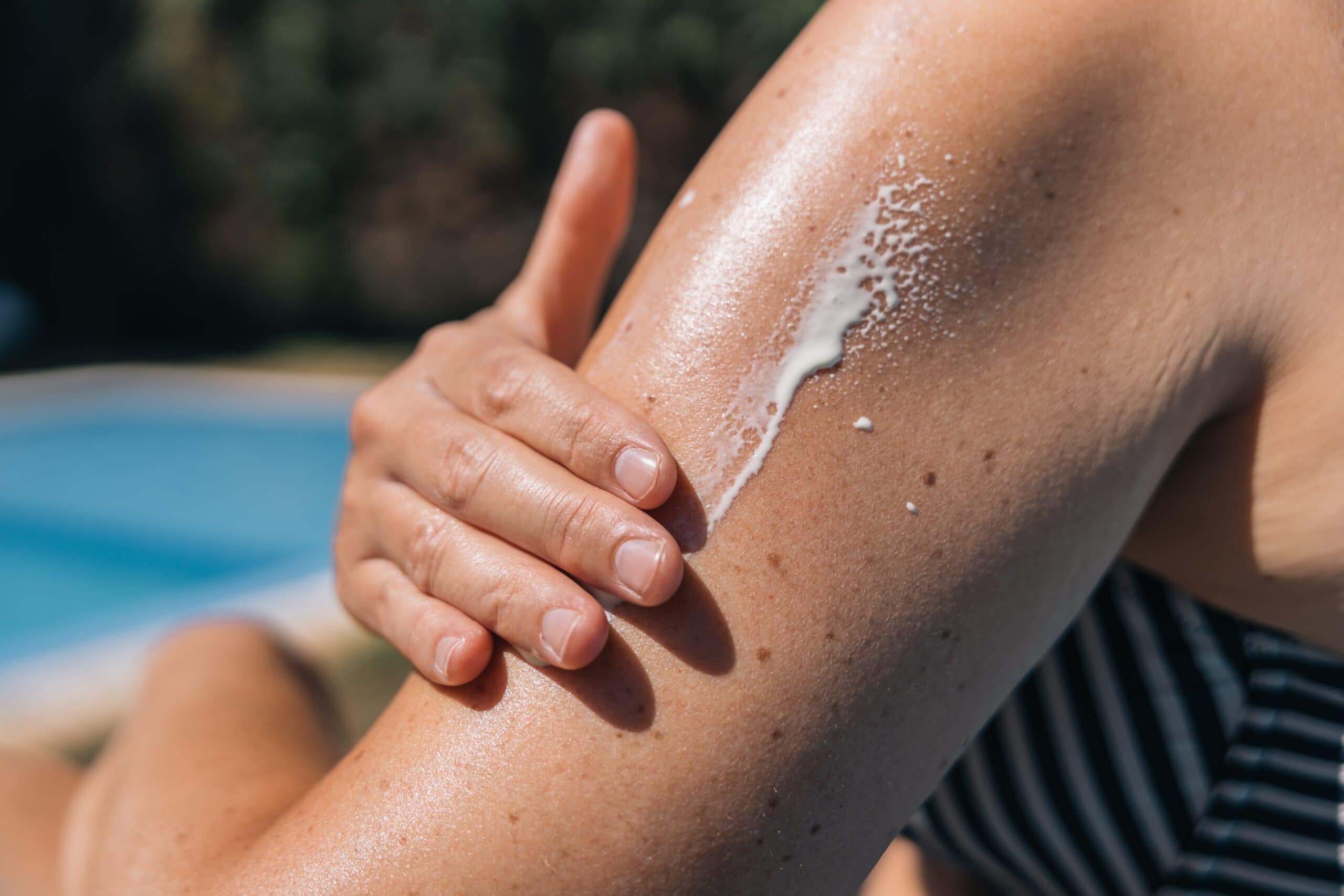 Importance of sunscreen in Florida